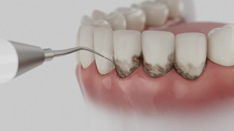 Trusted Teeth Whitening service in Lincoln Center, KS - Dentist Open Now